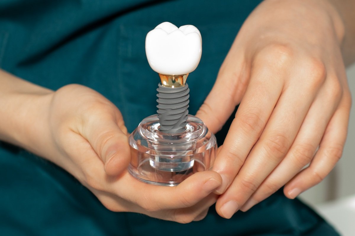 dental-implant-model-held-in-gentle-hands-2026-01-09-10-08-13-utc.jpg