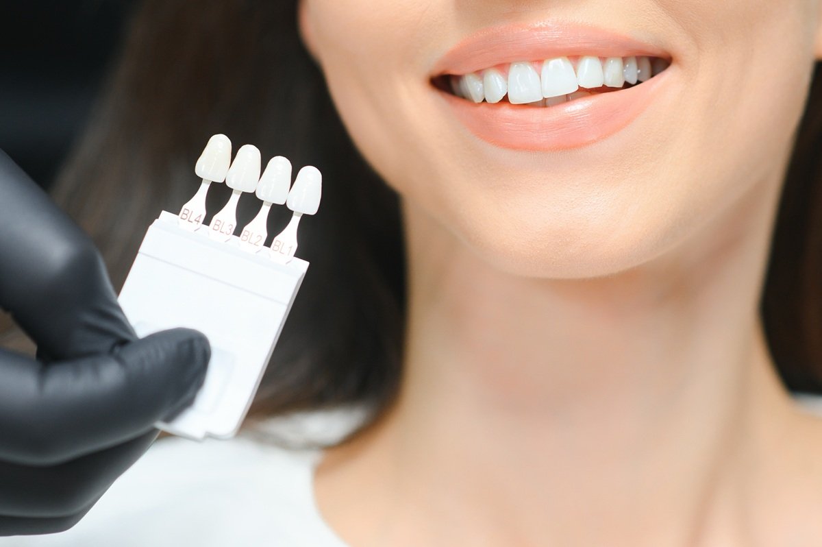 woman-smiling-with-tooth-shade-guide-in-hand-2026-01-05-00-09-37-utc.jpg